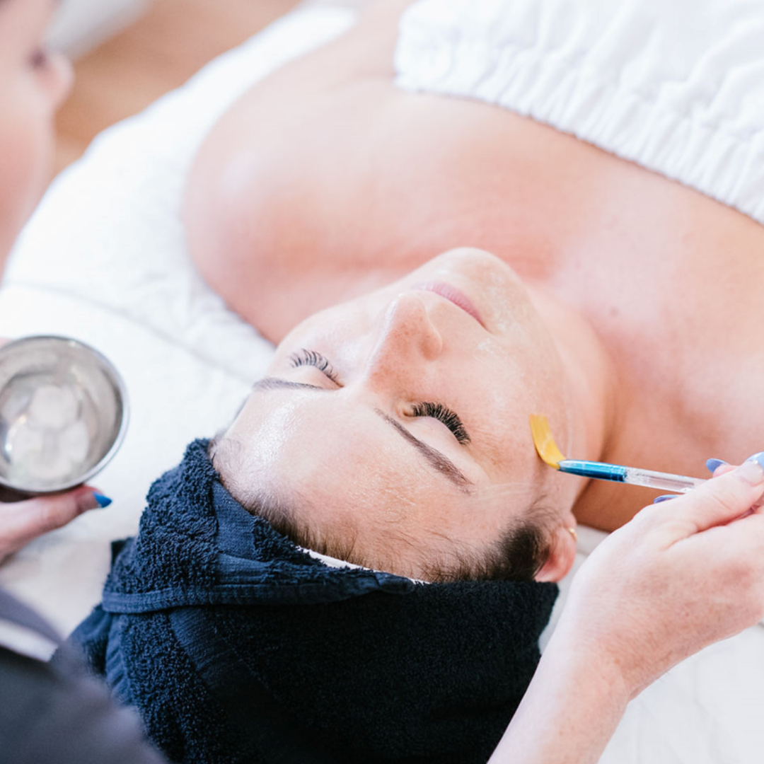 Chemical Peel