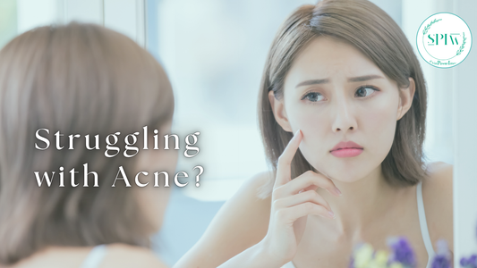 Struggling with Acne?
